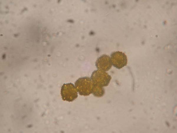 不明タンポポ花粉
